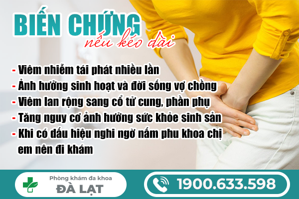 Hình ảnh minh họa